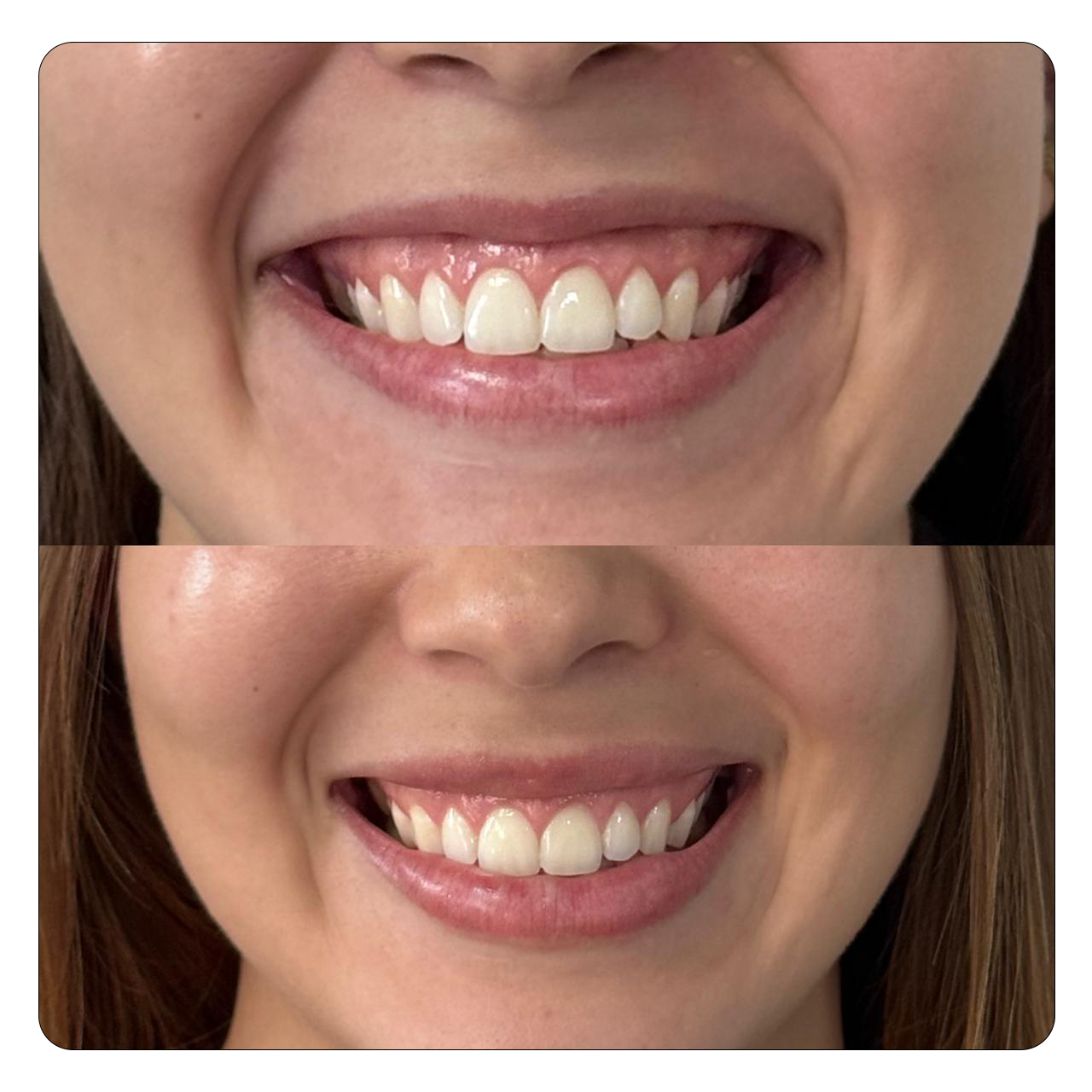 Natural Face - Resultado 4